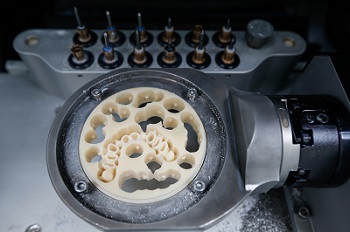 Dental CAD/CAM technology is used to fabricate abutments for dental implants, used to replace missing teeth CAD/CAM Dentistry