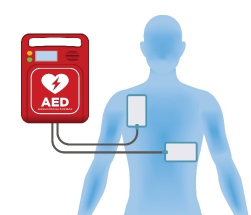 Get the right cable & wire assembly to make sure your AED works when it's needed Custom Wires & Cable Assembly for AED's