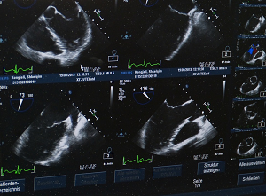 Fetal Monitor Transducers