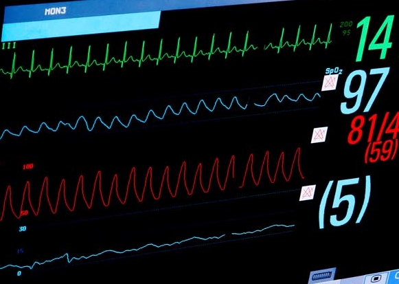 Custom Wires and Cable Assemblies for Neonatal ICU Monitors 