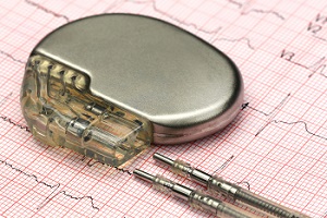 Lead wires are essential when assembling medical pacemakers Medical Pacemaker