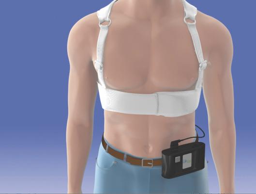 Custom wiring and cables for wearable cardioverter-defibrillators
